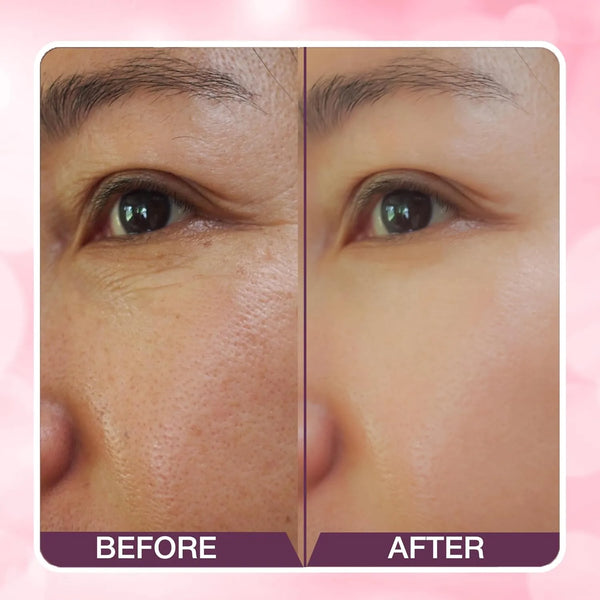 Hilary Rhoda Power of Blur Primer | Lightweight & Silicone-Based Primer | Matte Finish & Oil-Control Primer | Infused with Vitamin A & E | Water-Proof & Smoothening Primer | Long-Lasting Primer | 30ml